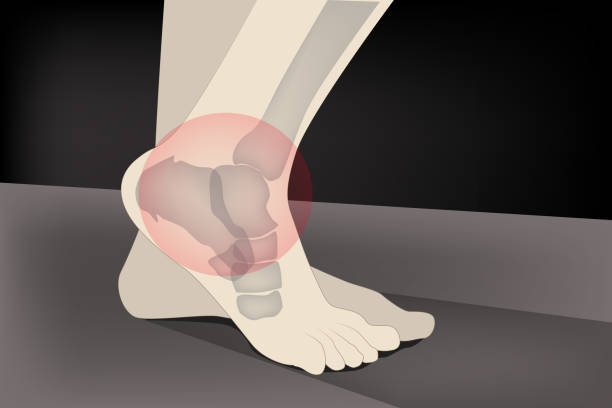 Is Heel Pain a Sign of Cancer 3